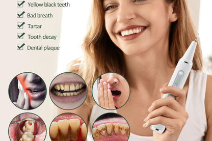 Teeth Cleaning Kit Plaque Remover Tartar Remover with 4 Replaceable Heads Rechargeable Teeth Cleaning Plaque Remover for Home