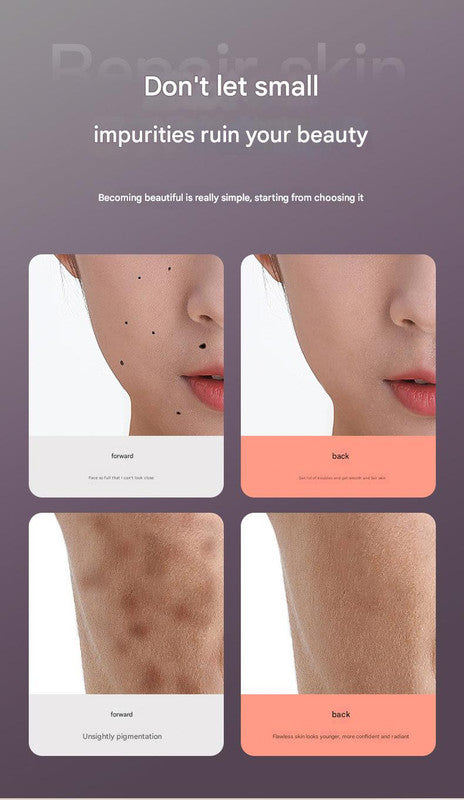 Professional 9-Level Skin Tag & Spot Remover Pen - USB Rechargeable Beauty Device(gold)