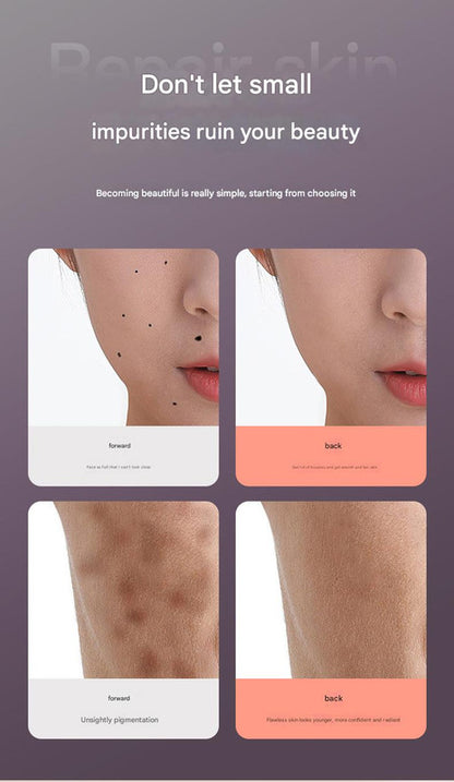 Professional 9-Level Skin Tag & Spot Remover Pen - USB Rechargeable Beauty Device(gold)