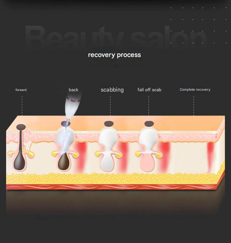 Professional 9-Level Skin Tag & Spot Remover Pen - USB Rechargeable Beauty Device(gold)