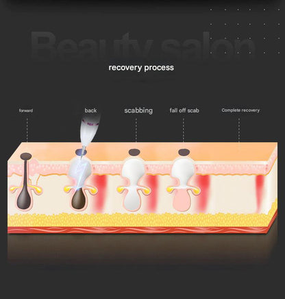 Professional 9-Level Skin Tag & Spot Remover Pen - USB Rechargeable Beauty Device(gold)